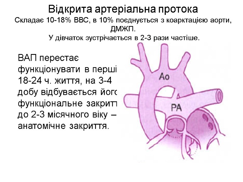 Відкрита артеріальна протока Складає 10-18% ВВС, в 10% поєднується з коарктацією аорти, ДМЖП. 
